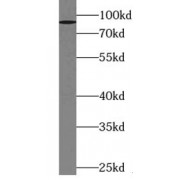 WB analysis of HEK-293 cells, using ZNF746 antibody (1/1000 dilution).