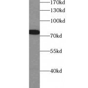 WB analysis of mouse thymus tissue, using ZNF750 antibody (1/500 dilution).