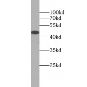 WB analysis of HeLa cells, usingNab09739 (ZNF763 antibody (1/1000 dilution).