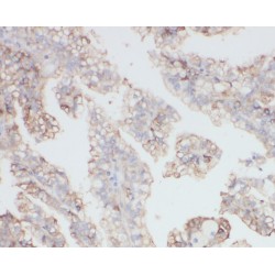 Zinc Finger Protein 839 (ZNF839) Antibody