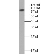 WB analysis of HeLa cells, using ZNF839 antibody (1/500 dilution).