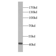 WB analysis of mouse brain tissue, using SLC30A3 antibody (1/1000 dilution).