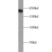 WB analysis of HepG2 cells, using ZO1 antibody (1/500 dilution).