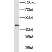 WB analysis of Recombinant proteins, using ZP3 antibody (1/500 dilution).