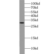 WB analysis of human skin tissue, using ZWINT antibody (1/300 dilution).
