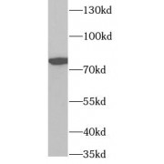 WB analysis of HeLa cells, using ZYX antibody (1/1000 dilution).