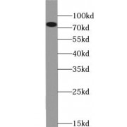 WB analysis of HeLa cells, using ZYX antibody (1/1000 dilution).