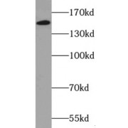 WB analysis of HEK-293 cells, using ZZZ3 antibody (1/1000 dilution).