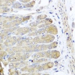 Insulin Receptor Substrate 2 (IRS2) Antibody
