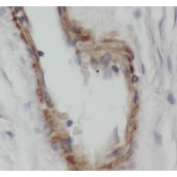 Calcitonin Gene Related Peptide 2 / CGRP2 (CALCB) Antibody