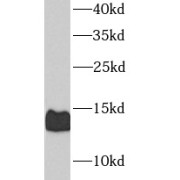 WB analysis of Jurkat cells, using CGRP-II antibody (1/1000 dilution).