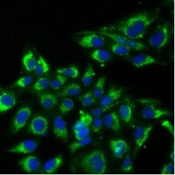 Thyroid Stimulating Hormone Beta (TSHb) Antibody