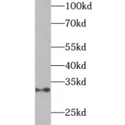 WB analysis of Jurkat cells, using Adiponectin (ADIPOQ) Antibody (1/1000 dilution).