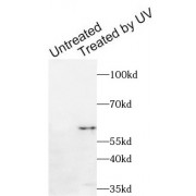 WB analysis of HT-29 cells, using Checkpoint Homolog Phospho-Ser280 (CHEK1 pS280) Antibody (1/1000 dilution).