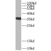WB analysis of HEK-293 cells, using VDAC1 antibody (1/1000 dilution).