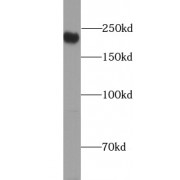 WB analysis of Raji cells, using CD45 antibody (1/1000 dilution).