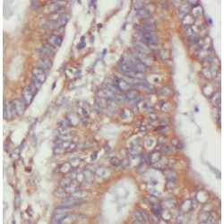 Angiomotin (AMOT) Antibody