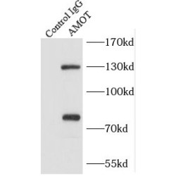 Angiomotin (AMOT) Antibody
