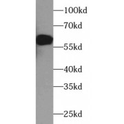 WB analysis of PC-12 cells, using TH antibody (1/3000 dilution).