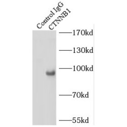 Catenin Beta (CTNNB1) Antibody