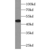 WB analysis of HeLa cells, using SLC2A1,GLUT1 antibody (1/1000 dilution).