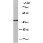 WB analysis of HeLa cells, using GOT1 antibody (1/1000 dilution).