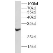 WB analysis of A549 cells, using IL2RA antibody (1/1000 dilution).