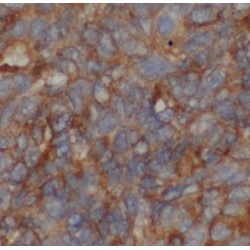 Angiopoietin-Related Protein 8 (ANGPTL8) Antibody