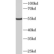 WB analysis of A549 cells, using METTL4 antibody (1/1000 dilution).