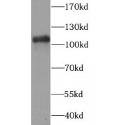 WB analysis of HeLa cells, using PARP1 antibody (1/20000 dilution).