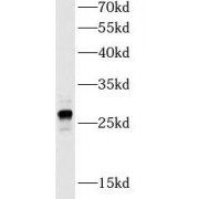 WB analysis of HeLa cells, using GSTM1 antibody (1/1000 dilution).