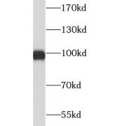 WB analysis of B cells, using XPOT antibody (1/1000 dilution).