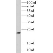 WB analysis of rat heart, using CD31 antibody (1/1000 dilution).