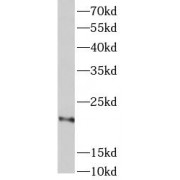 WB analysis of rat brain tissue, using galanin antibody (1/1000 dilution).