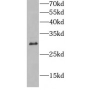 WB analysis of NIH/3T3 cells, using HLA-DQB1 antibody (1/1000 dilution).