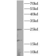 WB analysis of k562 cells, using RBTN2 antibody (1/1000 dilution).