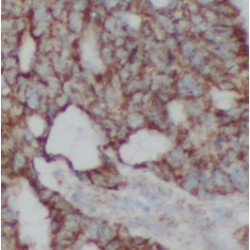 Peripheral Myelin Protein 22 (PMP22) Antibody