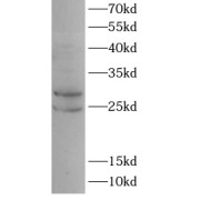 WB analysis of PC12 cells, using PMP22 antibody (1/1000 dilution).