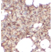IHC-P analysis of human lung tissue, using Periplakin antibody (1/100 dilution).
