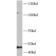 WB analysis of MCF7 cells, using NFKB1 antibody (1/1000 dilution).