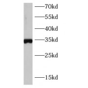WB analysis of MCF-7 cells, using SOX2 antibody (1/1000 dilution).
