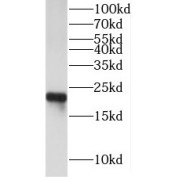 WB analysis of Mouse heart tissue, using cygb antibody (1/1000 dilution).