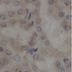 SHARPIN (SHARPIN) Antibody