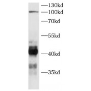 WB analysis of Jurkat cells, using SHARPIN antibody (1/500 dilution).