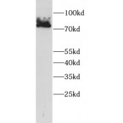 WB analysis of HeLa cells, using ECD antibody (1/1000 dilution).
