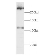 WB analysis of HeLa cells, using UTRO antibody (1/800 dilution).
