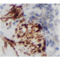 Transcriptional Repressor CTCFL (CTCFL) Antibody