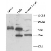WB analysis of various lysates, using BORIS antibody (1/1000 dilution).