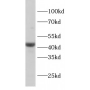 WB analysis of HeLa cells, using ADIPOR1 antibody (1/1000 dilution).