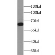 WB analysis of A549 cells, using Pan-AKT antibody (1/500 dilution).